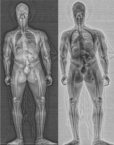  RadPRO SecurPASS scan