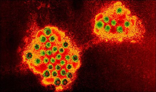 norovirus graphic