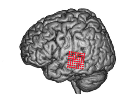 Click to enlarge Auditory Brain