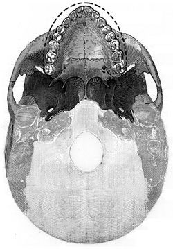 Click to enlarge maxilia from underneath