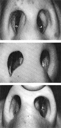 Click to enlarge septum