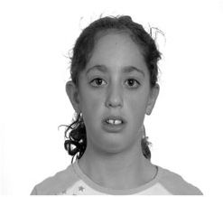 Click to enlarge weak jaw 1