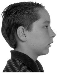 Click to enlarge weak jaw 2
