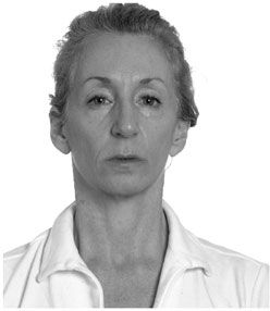 Click to enlarge weak jaw 3