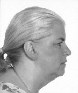 Click to enlarge forward head