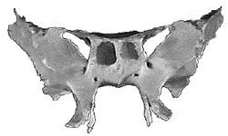 Click to enlarge sphenoid