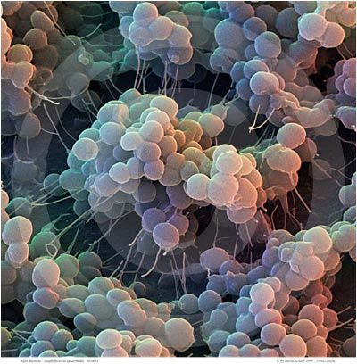 staph bacteria