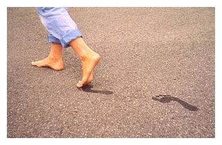 Click to enlarge Barefeet