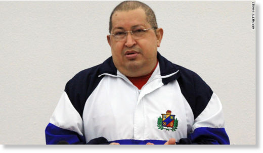 Hugo Chavez