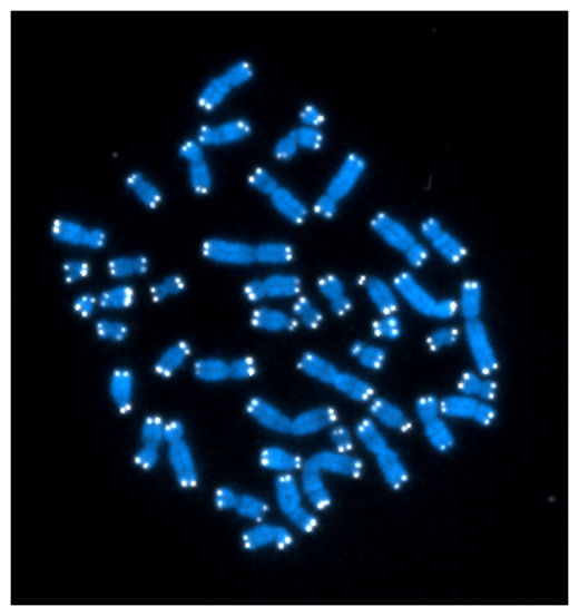 Click to enlarge Telomeres