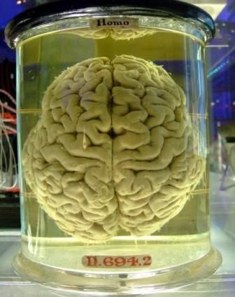 Human brain