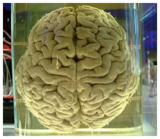 Brain