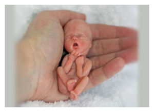Fetus