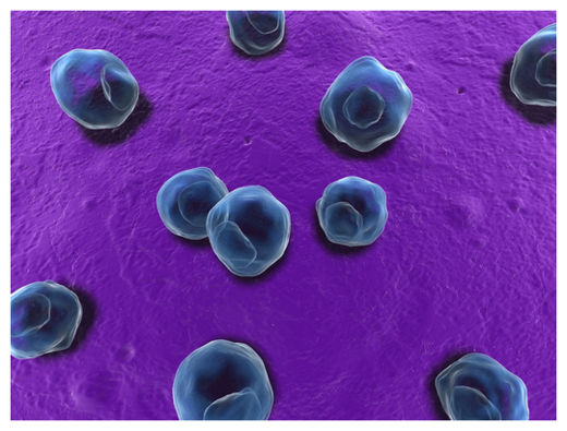 Click to enlarge Chlamydia