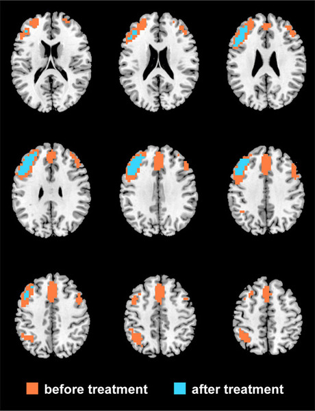 Brain Scans