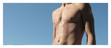 Click to enlarge Skin Pigment