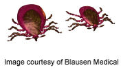 Click to enlarge ticks