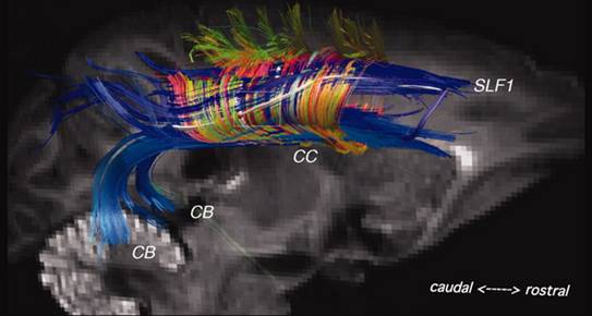cerebral pathways