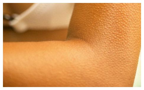Click to enlarge Goose Bumps