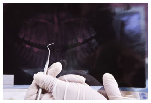 Dental Exam