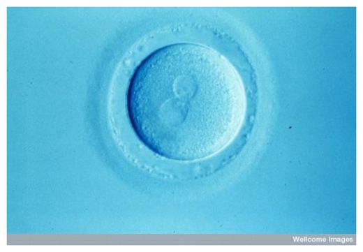 Fertilized Human Egg