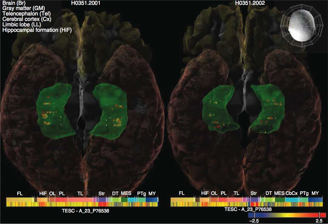 Brain Genetics