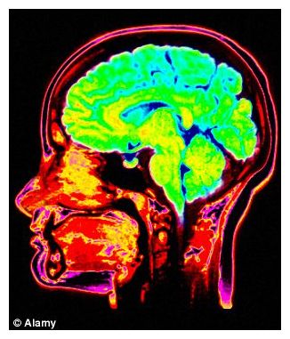 Click to enlarge Human Brain