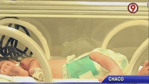 argentine miracle baby