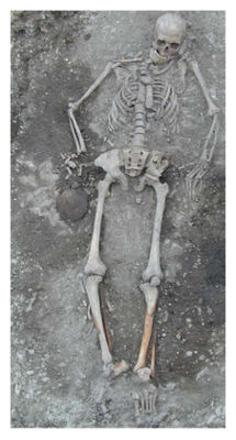 Click to enlarge Skeleton