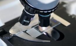 colldictyon man's ancestors microscope