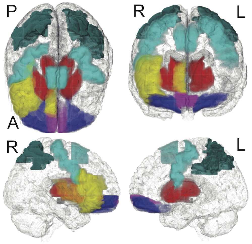 Brain Scan