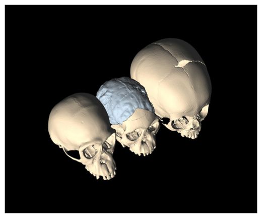 Click to enlarge Skull