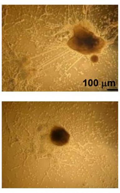 stem cell differentiation