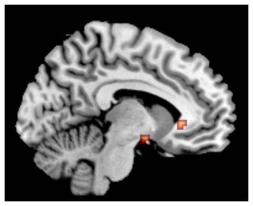 Brain