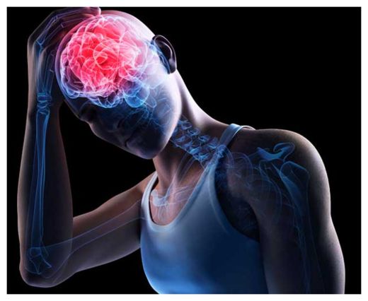 Concussion