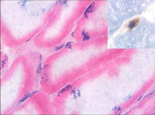 Human muscle