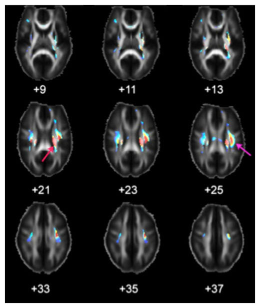 Brain Scan