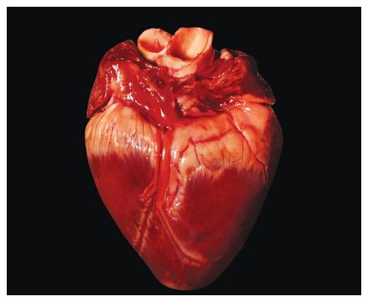 Heart