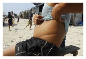 Organ Trade