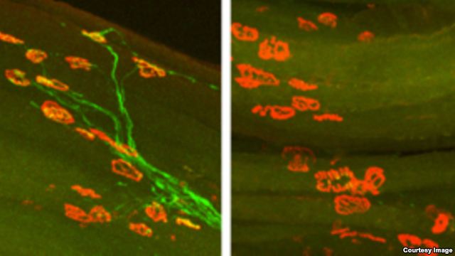 Axon Regeneration