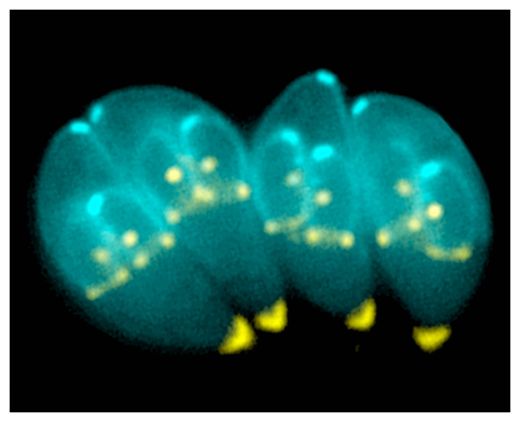 Toxoplasma Gondii