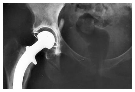 X-Ray