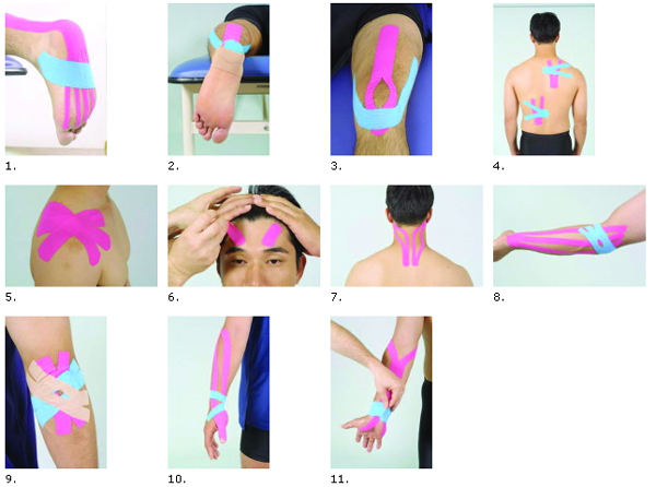 Kinesio Tapes