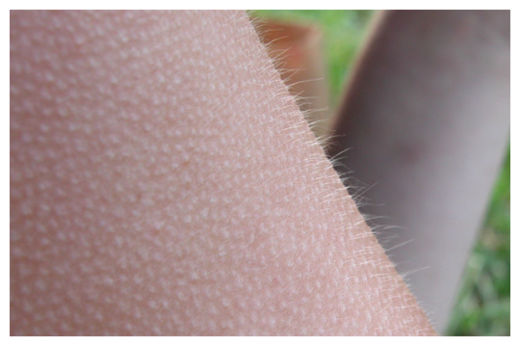 Goose Bumps