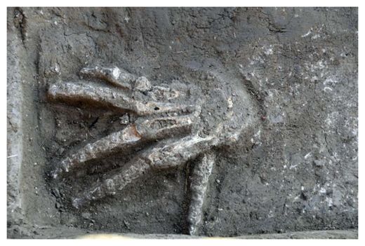 Click to enlarge Severed Hand