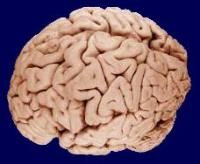 Brain change