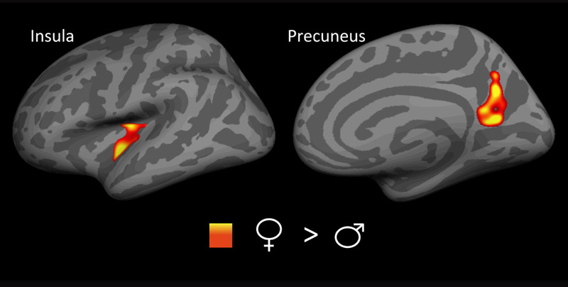 Brain Scans