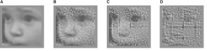 Click to enlarge Prosthetic Retina