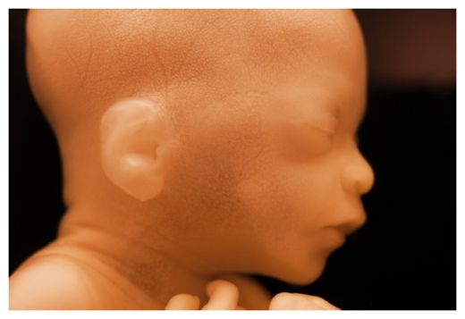 Unborn