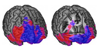 Brain Map